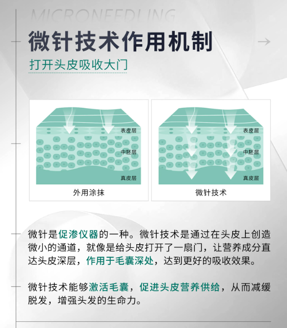 微针生发