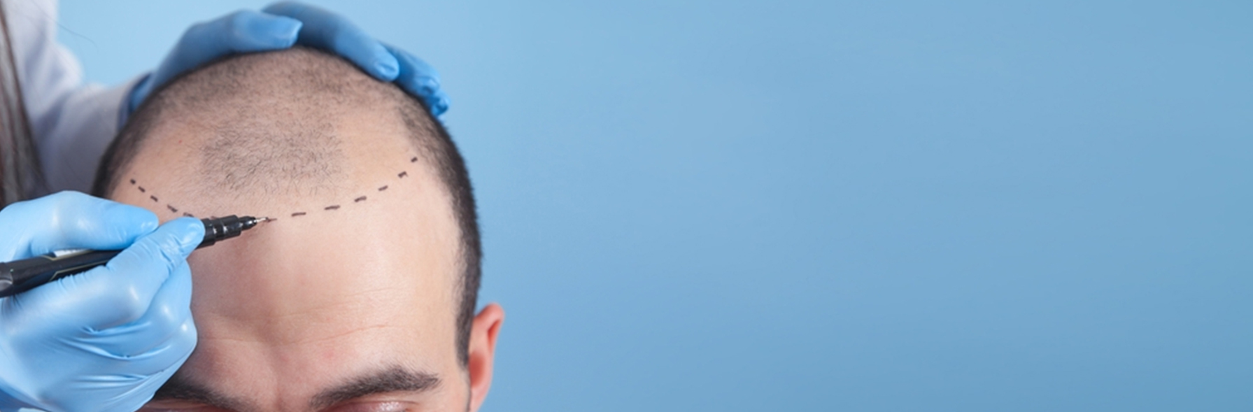 生发水有效果吗